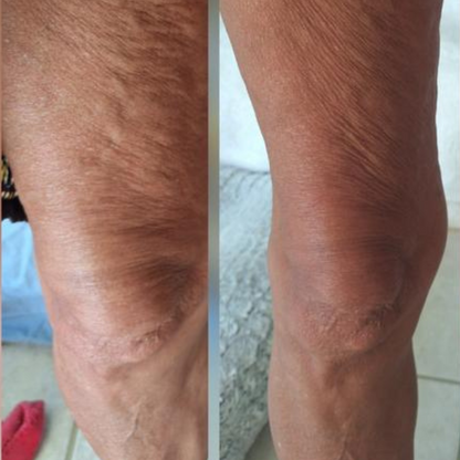 Anti-Cellulite Massage Oil